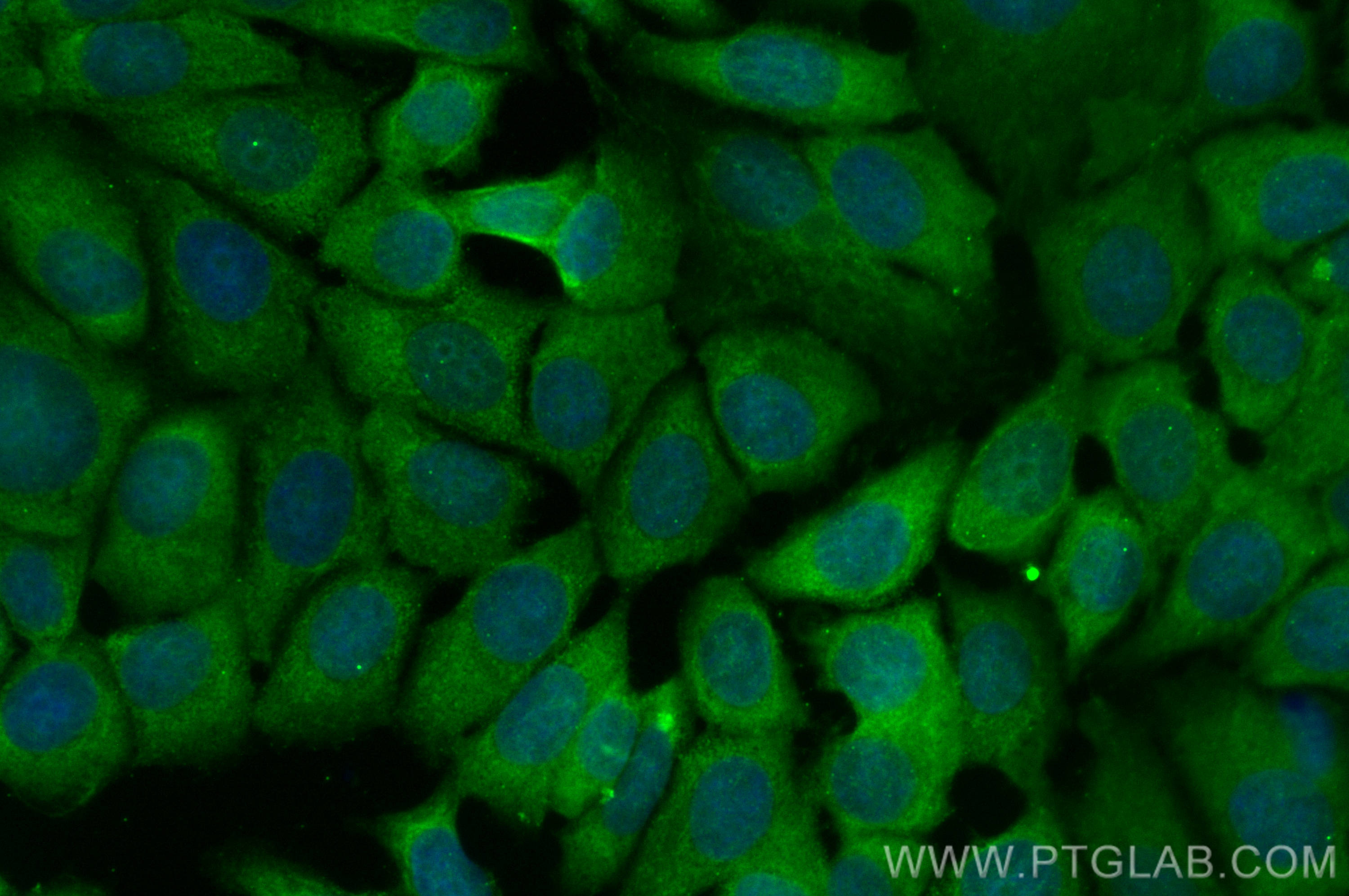 IF Staining of MCF-7 using CL488-22104