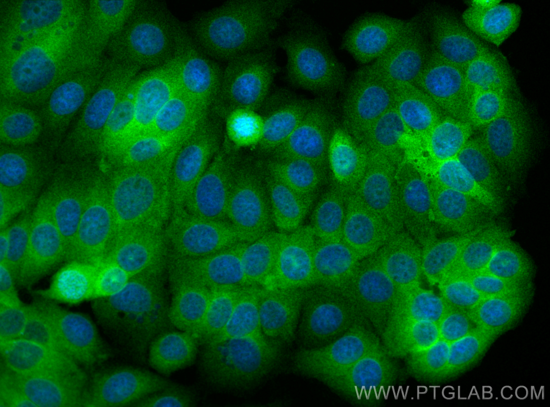 IF Staining of MCF-7 using RMX00019