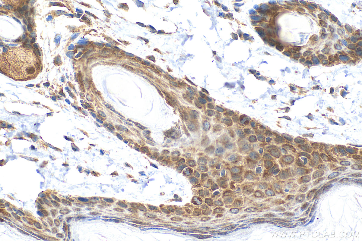IHC staining of mouse skin using RMX00019