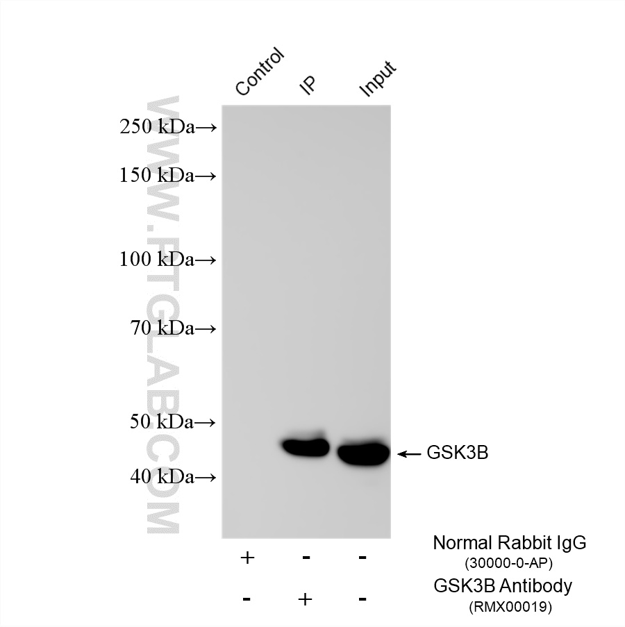 IP experiment of HeLa using RMX00019 IP experiment of HeLa using RMX00019