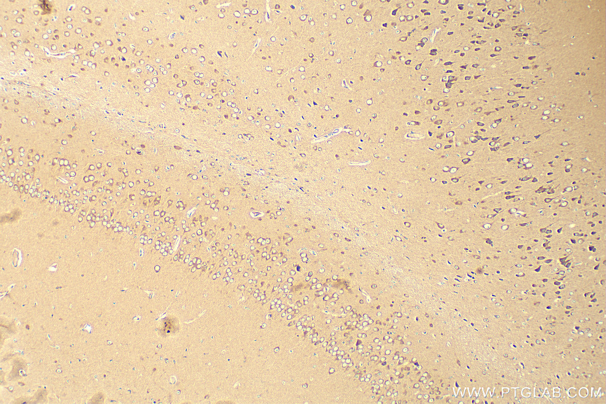 IHC staining of mouse brain using 10763-1-AP