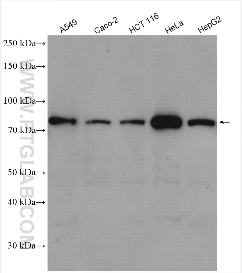 WB analysis using 10763-1-AP