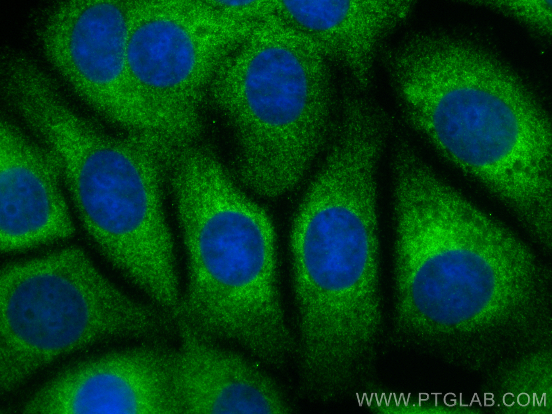 IF Staining of MCF-7 using 12989-1-AP