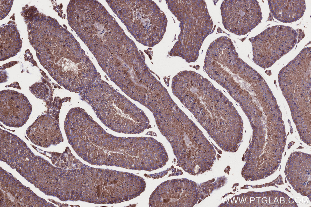 IHC staining of mouse testis using 12989-1-AP IHC staining of mouse testis using 12989-1-AP