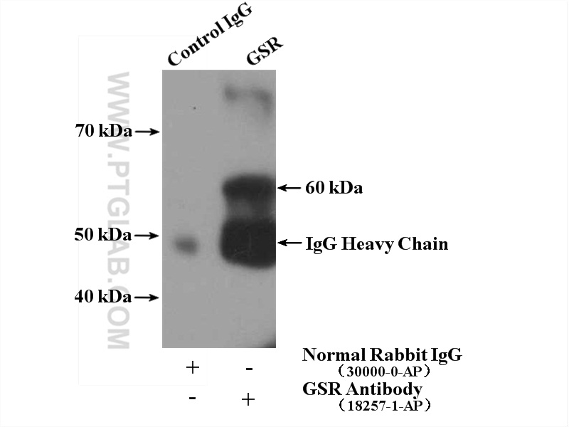 IP experiment of HeLa using 18257-1-AP