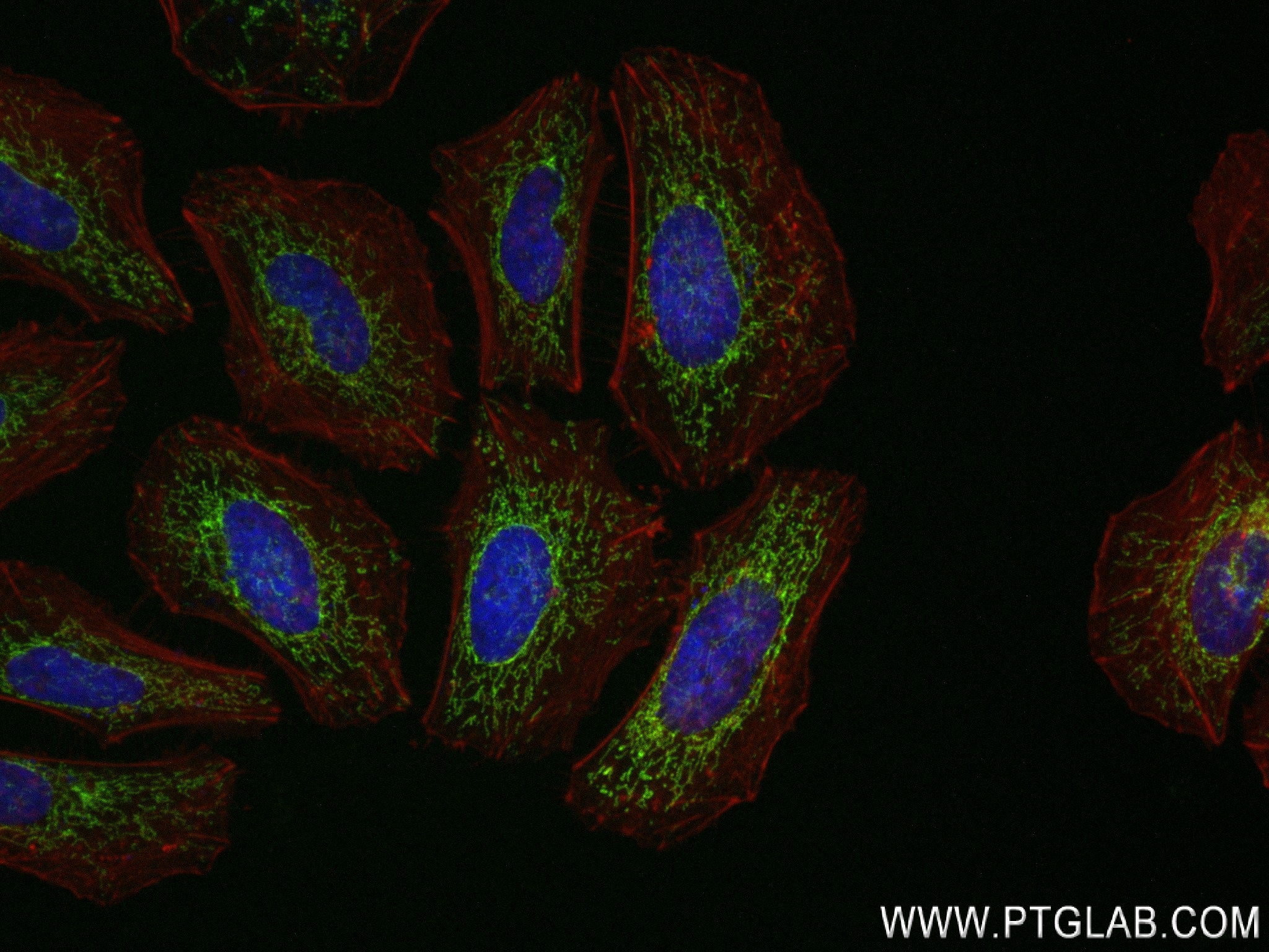 IF Staining of HeLa using 84480-2-RR