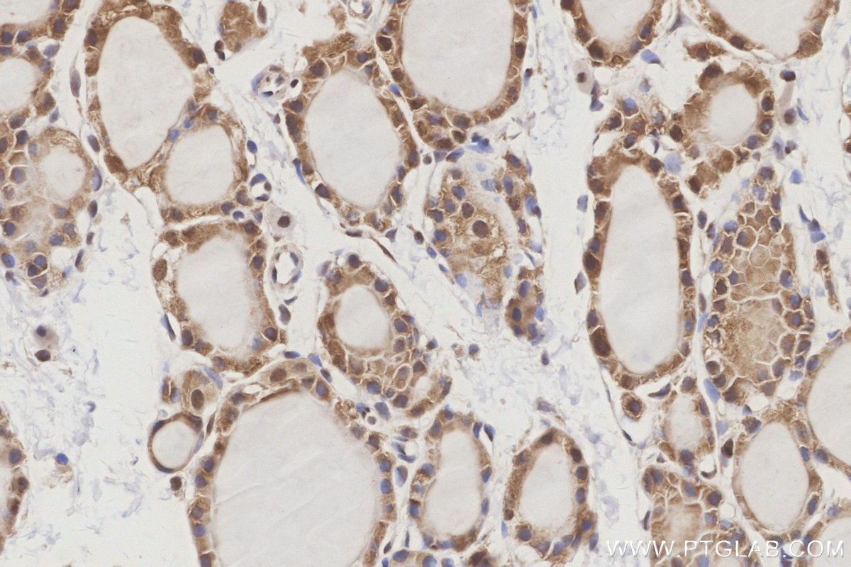IHC staining of rat thyroid gland using 84480-2-RR IHC staining of rat thyroid gland using 84480-2-RR