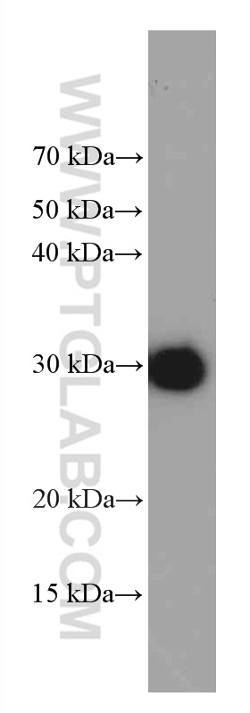 WB analysis of Recombinant protein using 66001-2-Ig