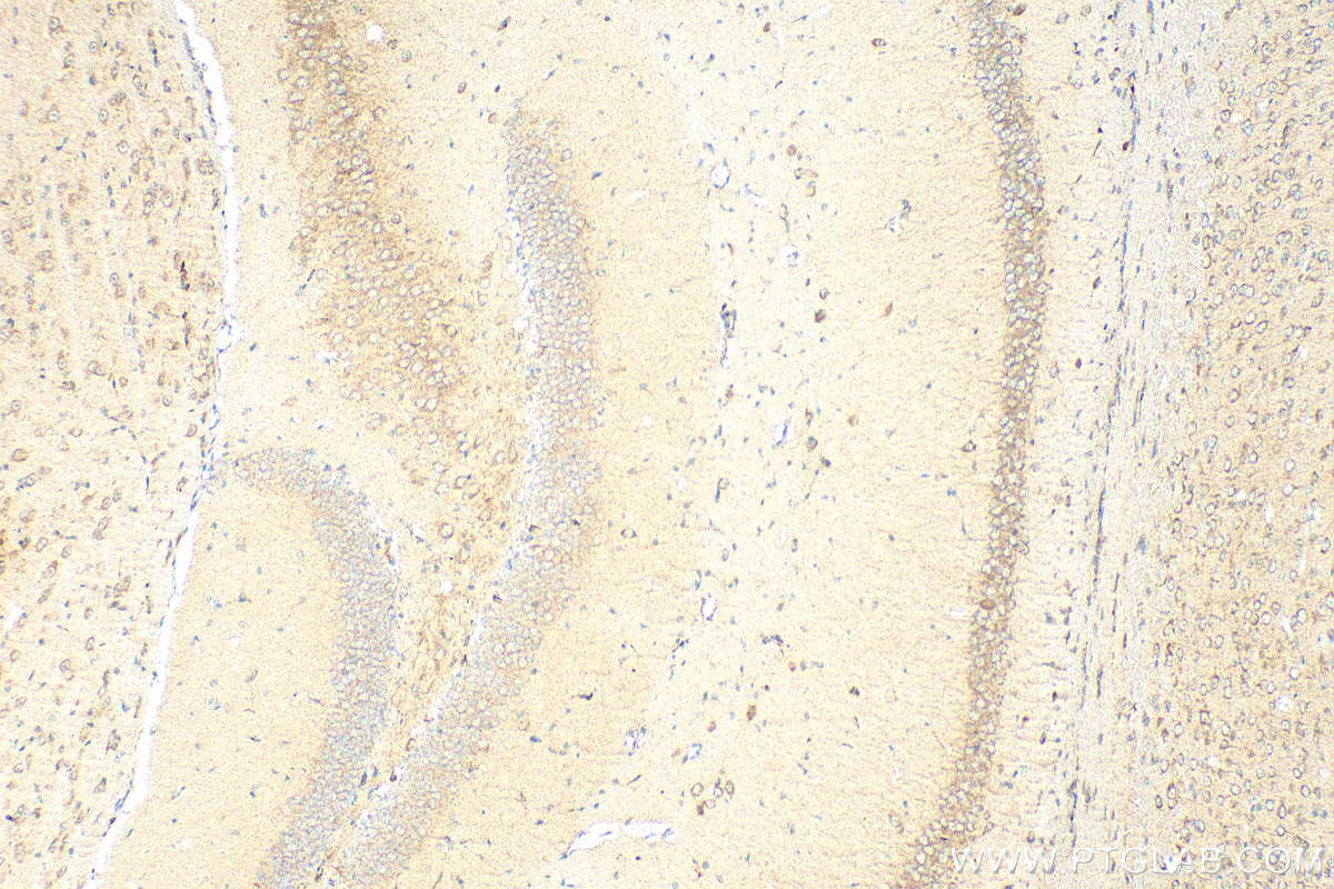 IHC staining of mouse brain using 10505-1-AP
