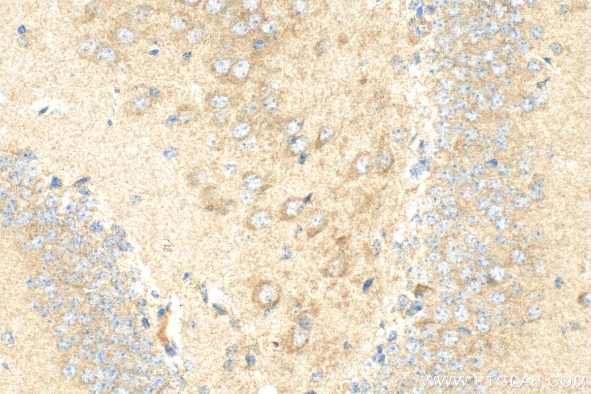 IHC staining of mouse brain using 10505-1-AP