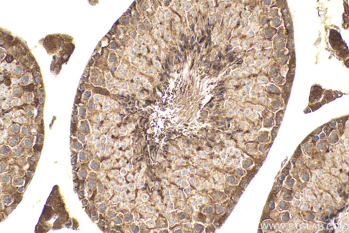 IHC staining of mouse testis using 16703-1-AP