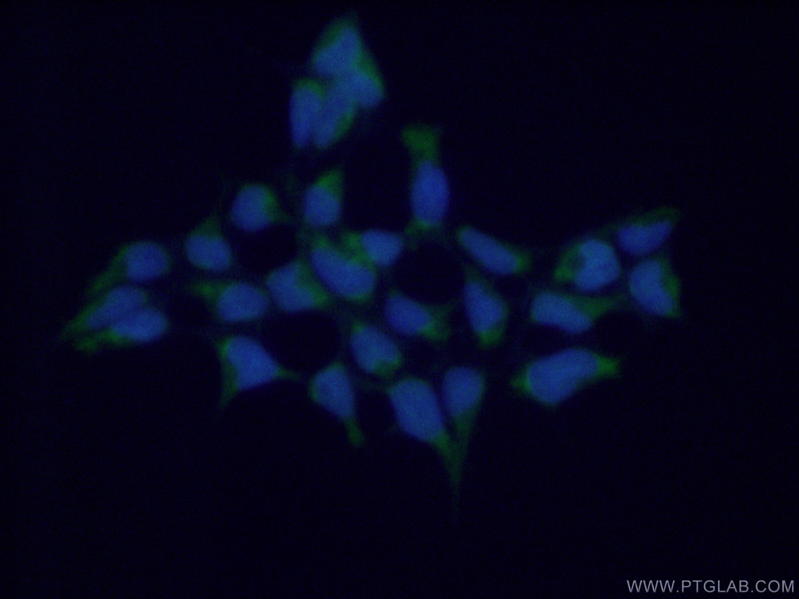 IF Staining of HEK-293 using 17271-1-AP