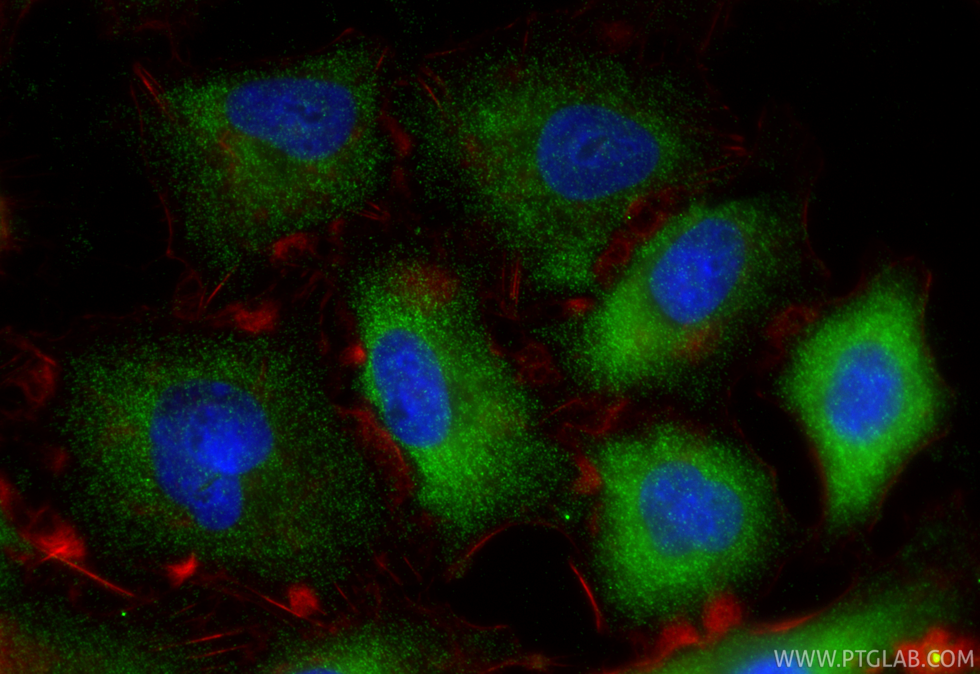 IF Staining of A549 using 17271-1-AP