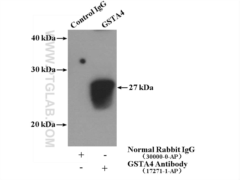 IP experiment of SH-SY5Y using 17271-1-AP