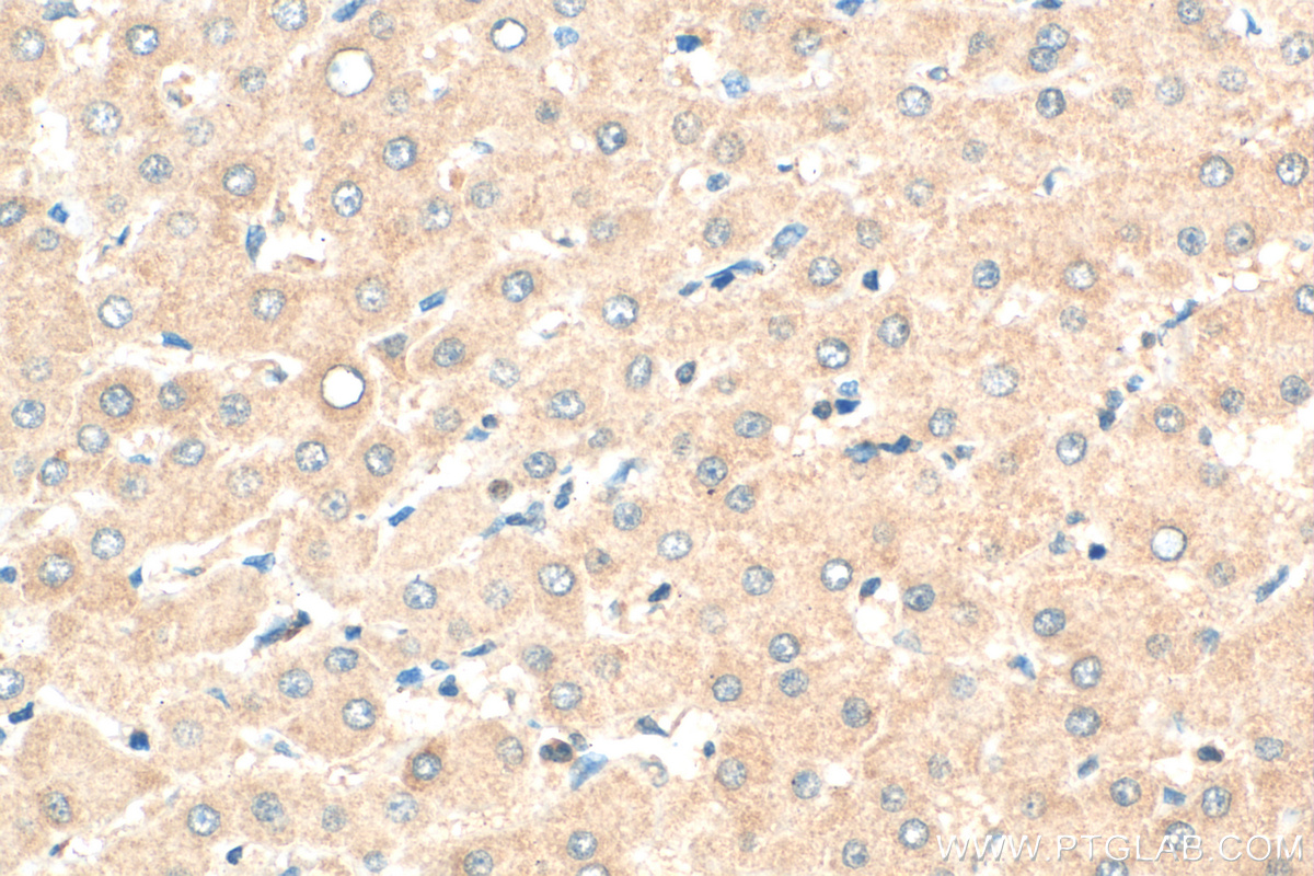 IHC staining of human liver using 17502-1-AP