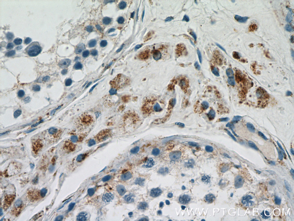 IHC staining of human testis using 14535-1-AP