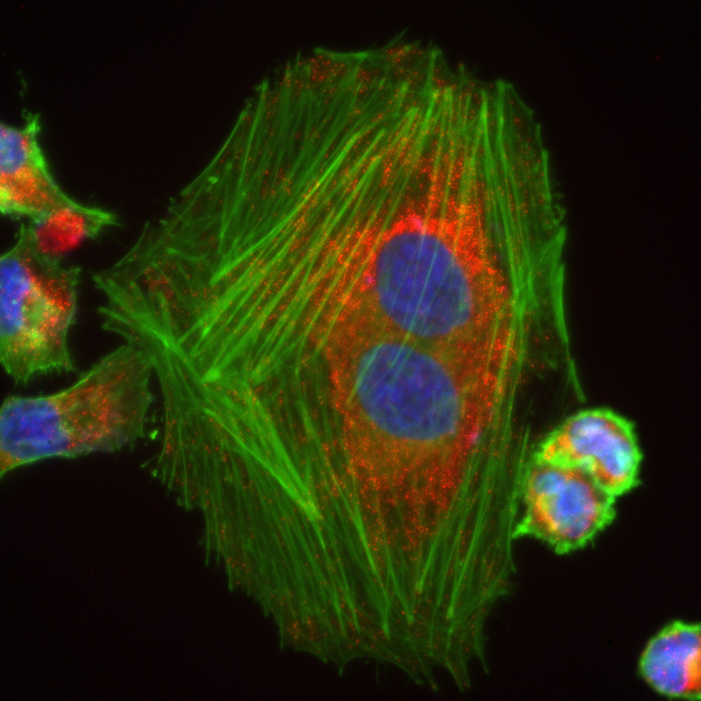 IF Staining of HeLa using 81527-1-RR (same clone as 81527-1-PBS)