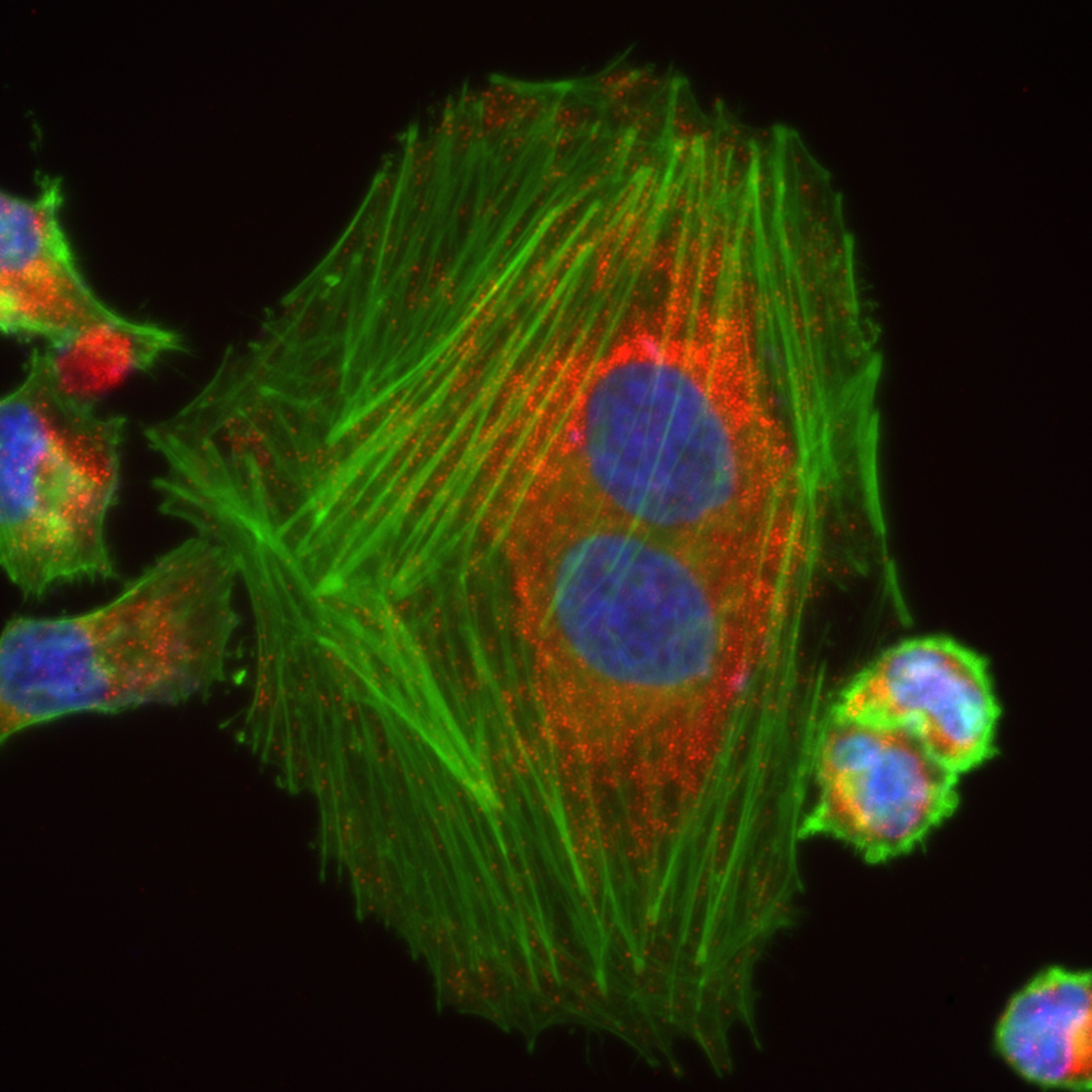 IF Staining of HeLa using 81527-1-RR