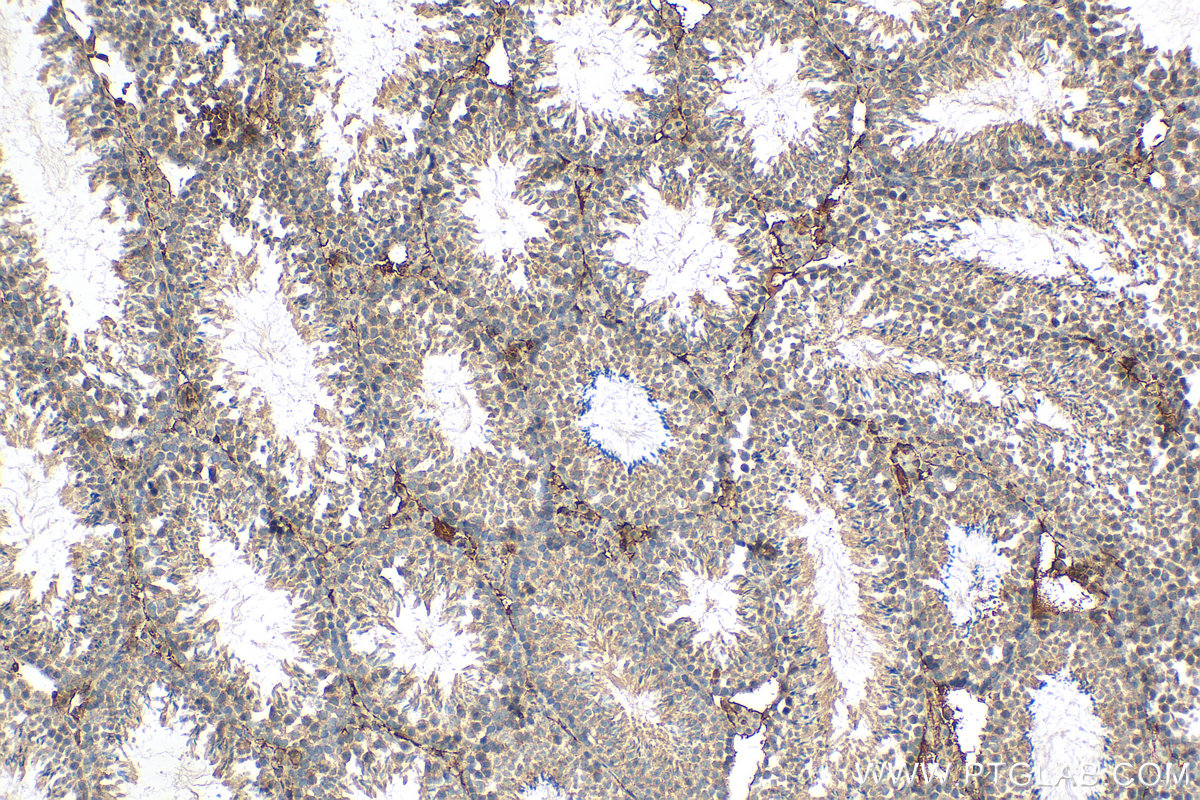IHC staining of mouse testis using 81527-1-RR (same clone as 81527-1-PBS)