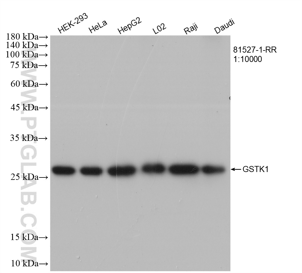 WB analysis using 81527-1-RR (same clone as 81527-1-PBS)