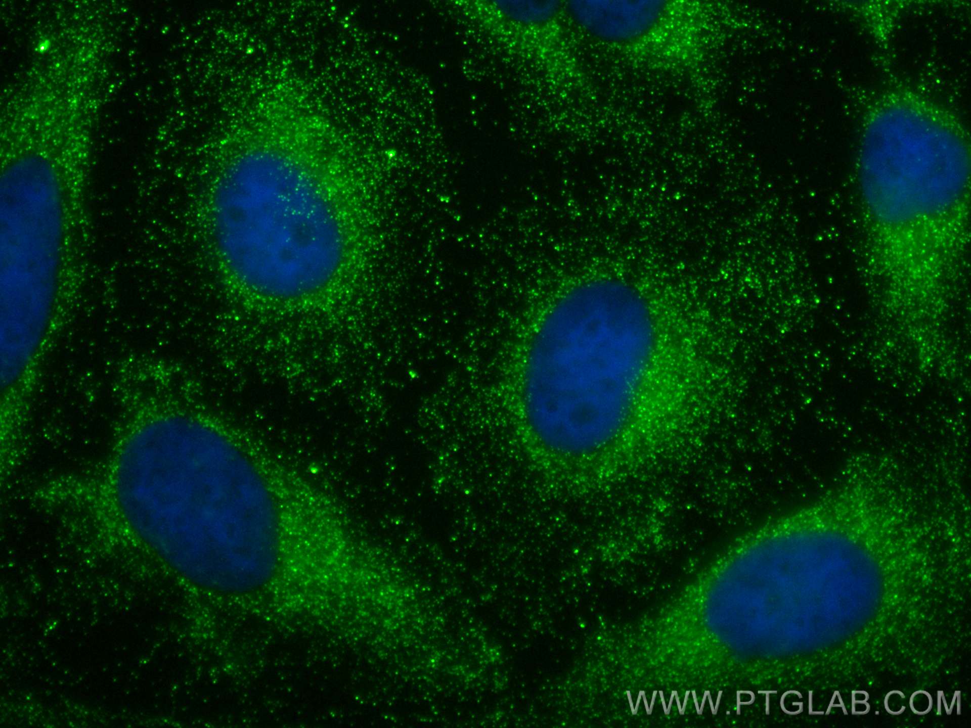 IF Staining of HeLa using 12412-1-AP