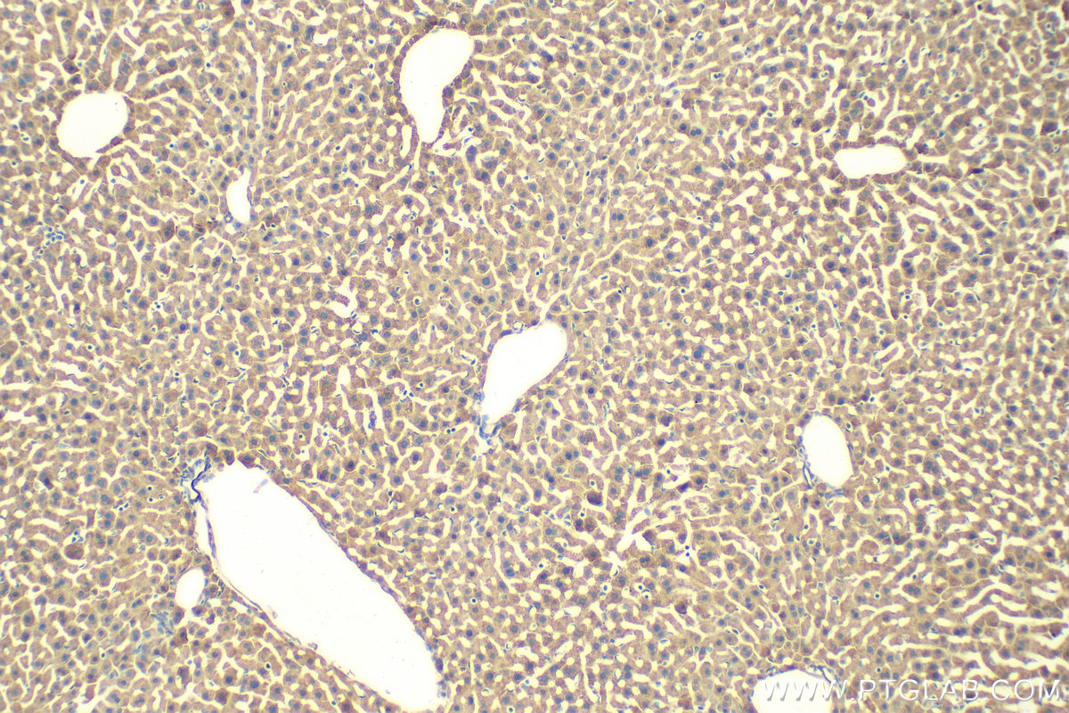 IHC staining of mouse liver using 12412-1-AP