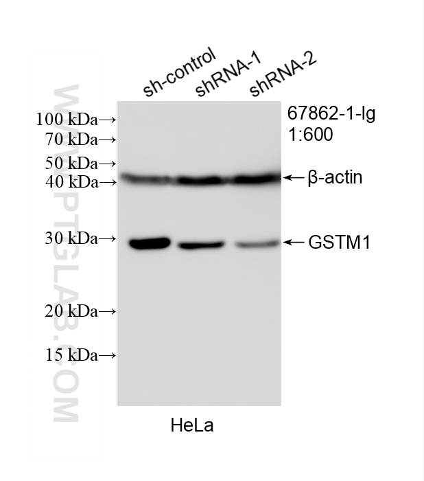 WB analysis of HeLa using 67862-1-Ig