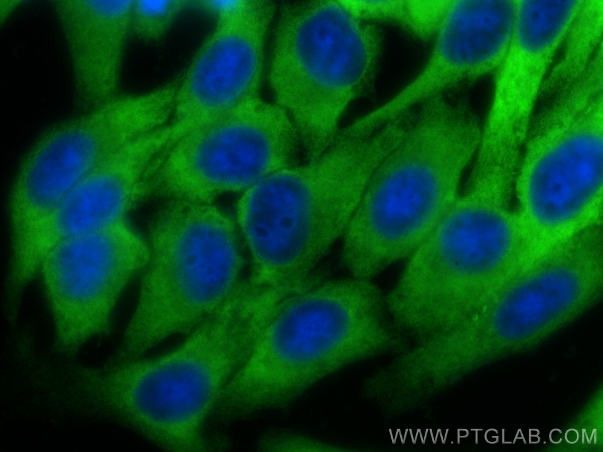 IF Staining of HepG2 using 15214-1-AP