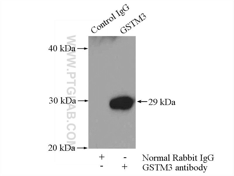 IP experiment of mouse testis using 15214-1-AP