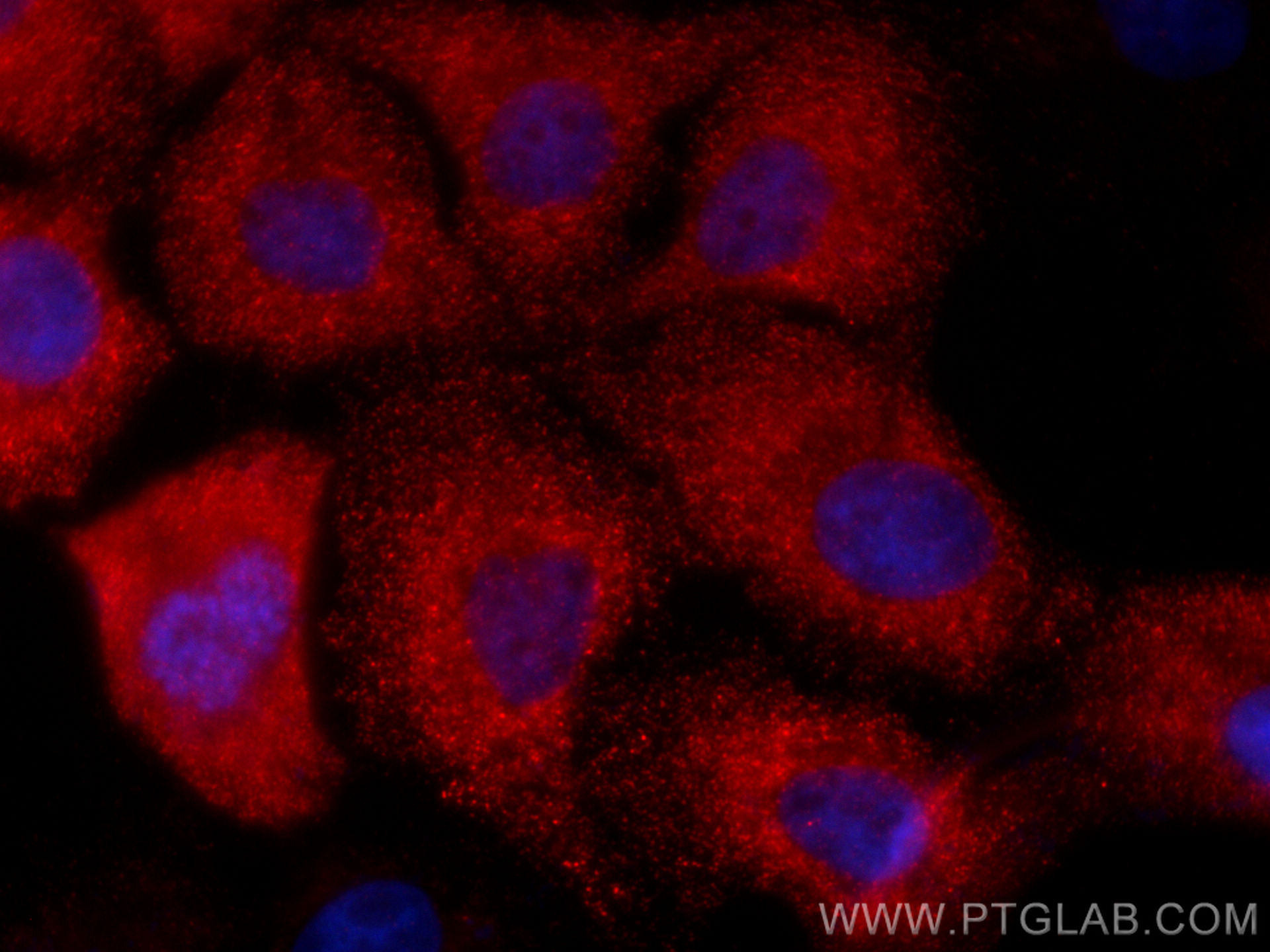 IF Staining of A431 using CL594-67634