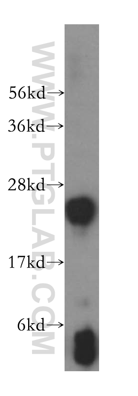 WB analysis of mouse liver using 16766-1-AP