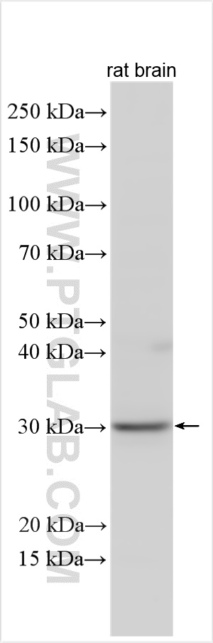 WB analysis of rat brain using 15124-1-AP