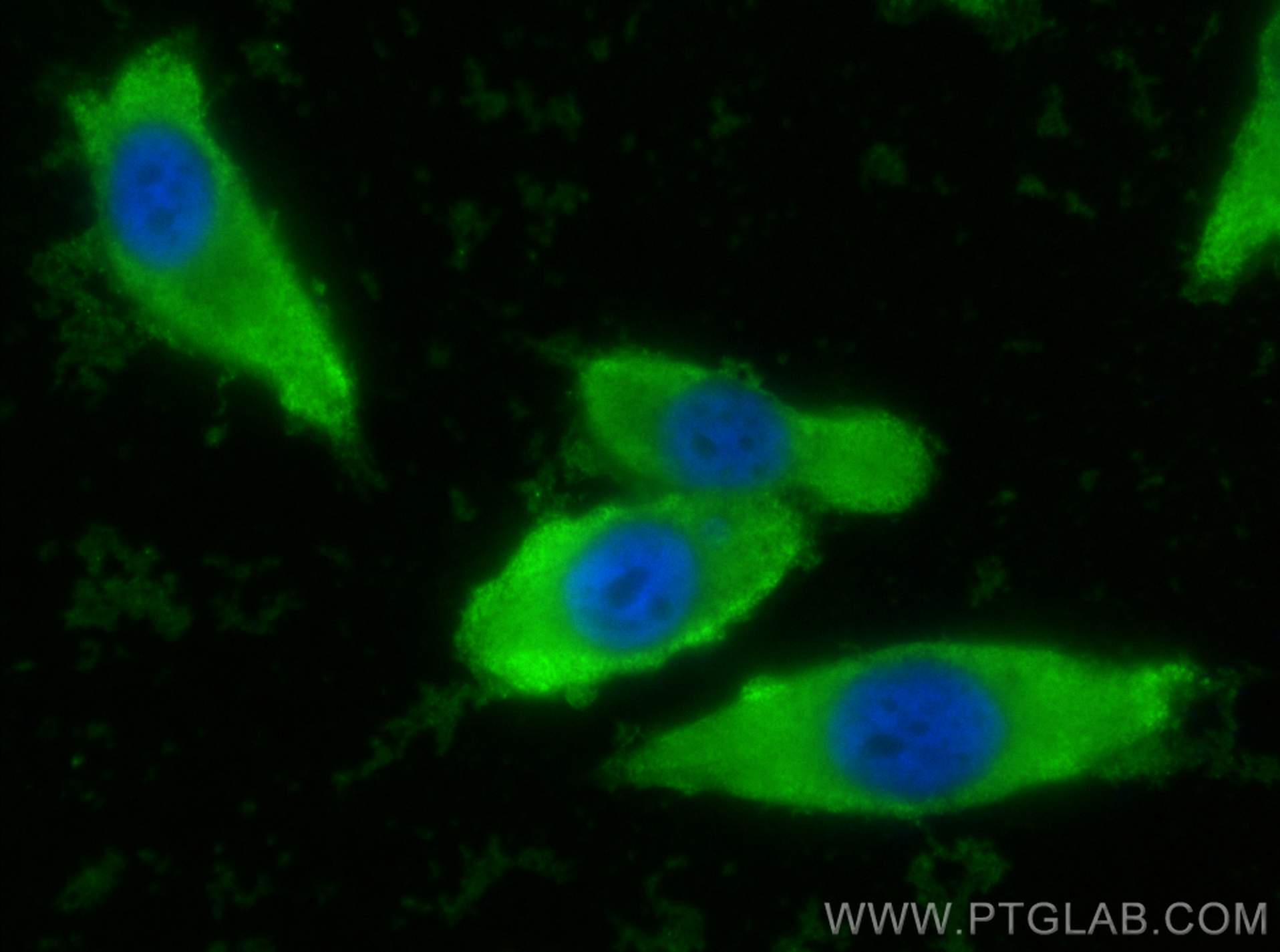 IF Staining of PC-3 using CL488-60150