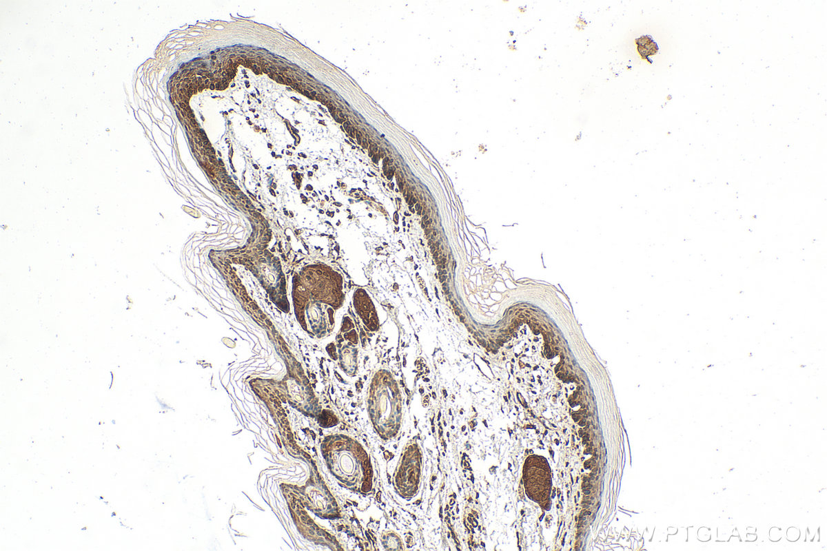 IHC staining of mouse skin using 15902-1-AP