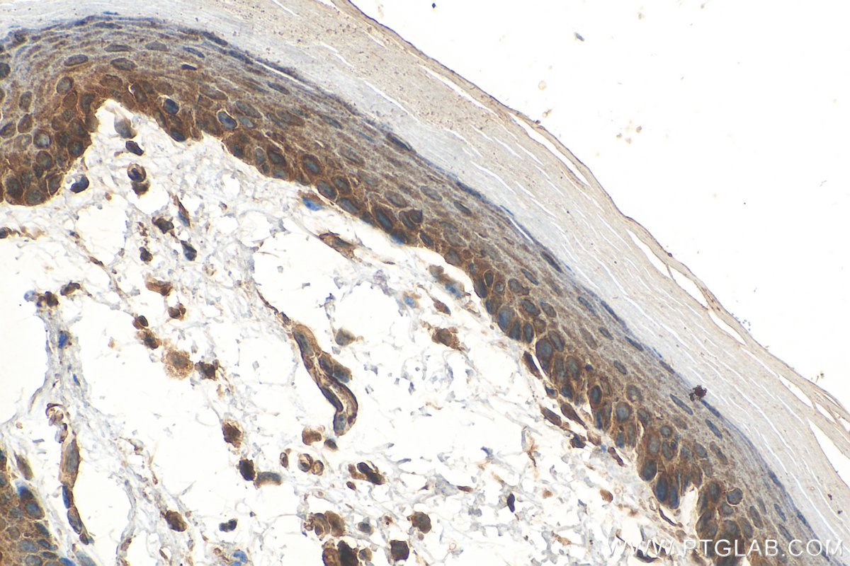 IHC staining of mouse skin using 15902-1-AP