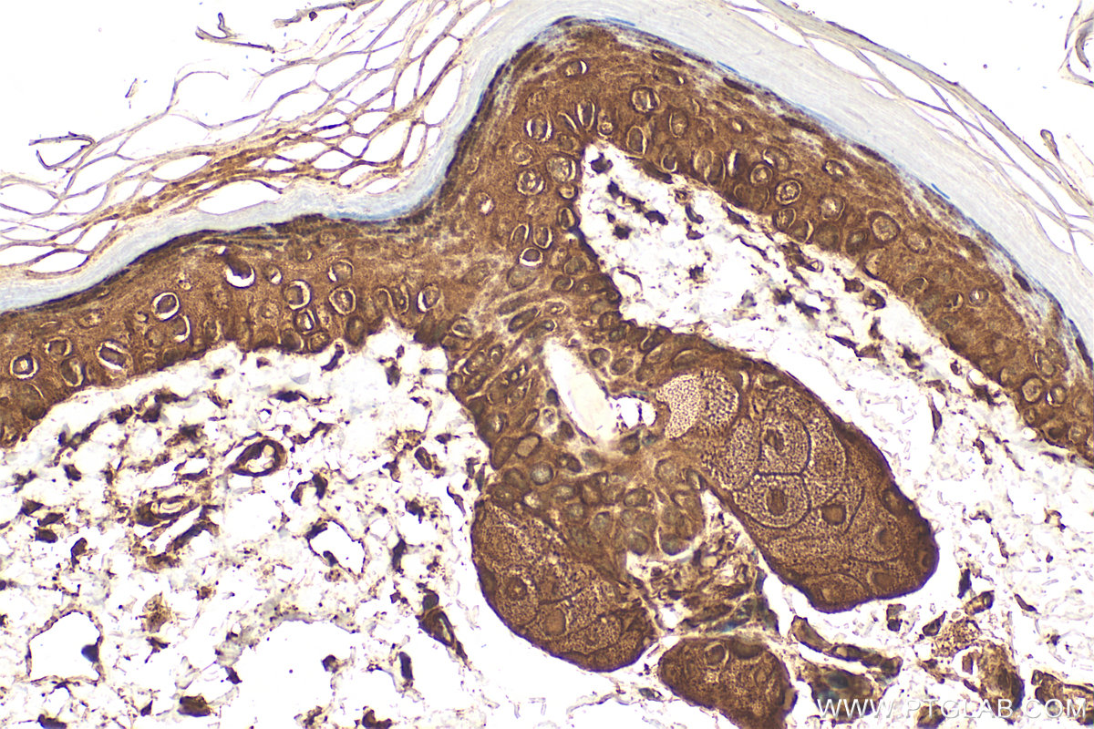 IHC staining of mouse skin using 15902-1-AP IHC staining of mouse skin using 15902-1-AP