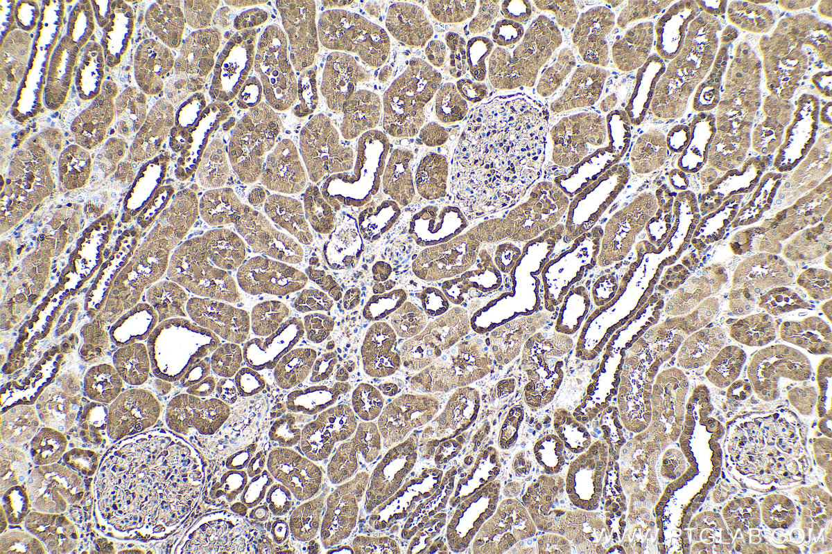 IHC staining of human kidney using 66715-1-Ig (same clone as 66715-1-PBS)