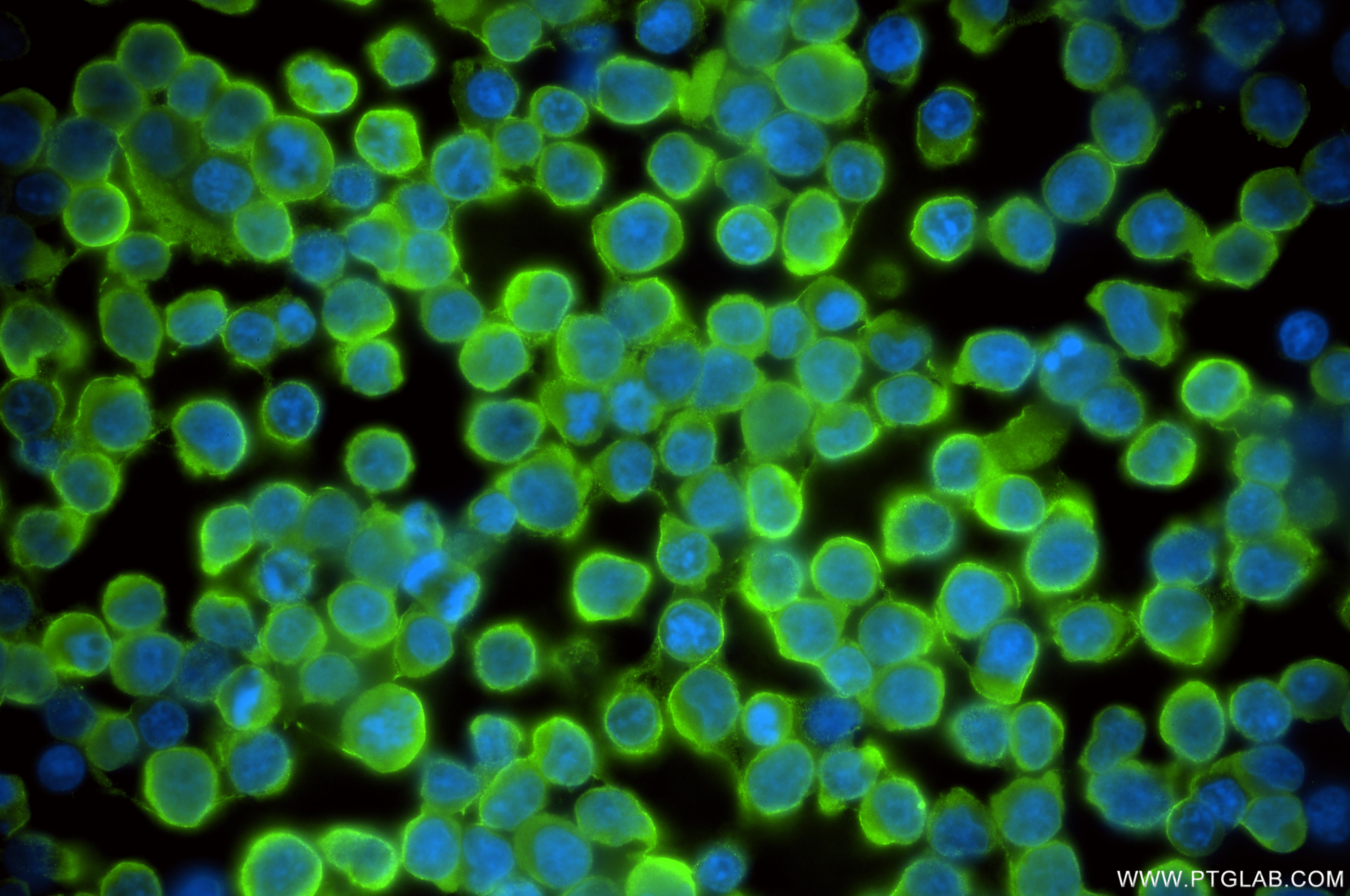 IF Staining of Jurkat using 86708-1-RR IF Staining of Jurkat using 86708-1-RR