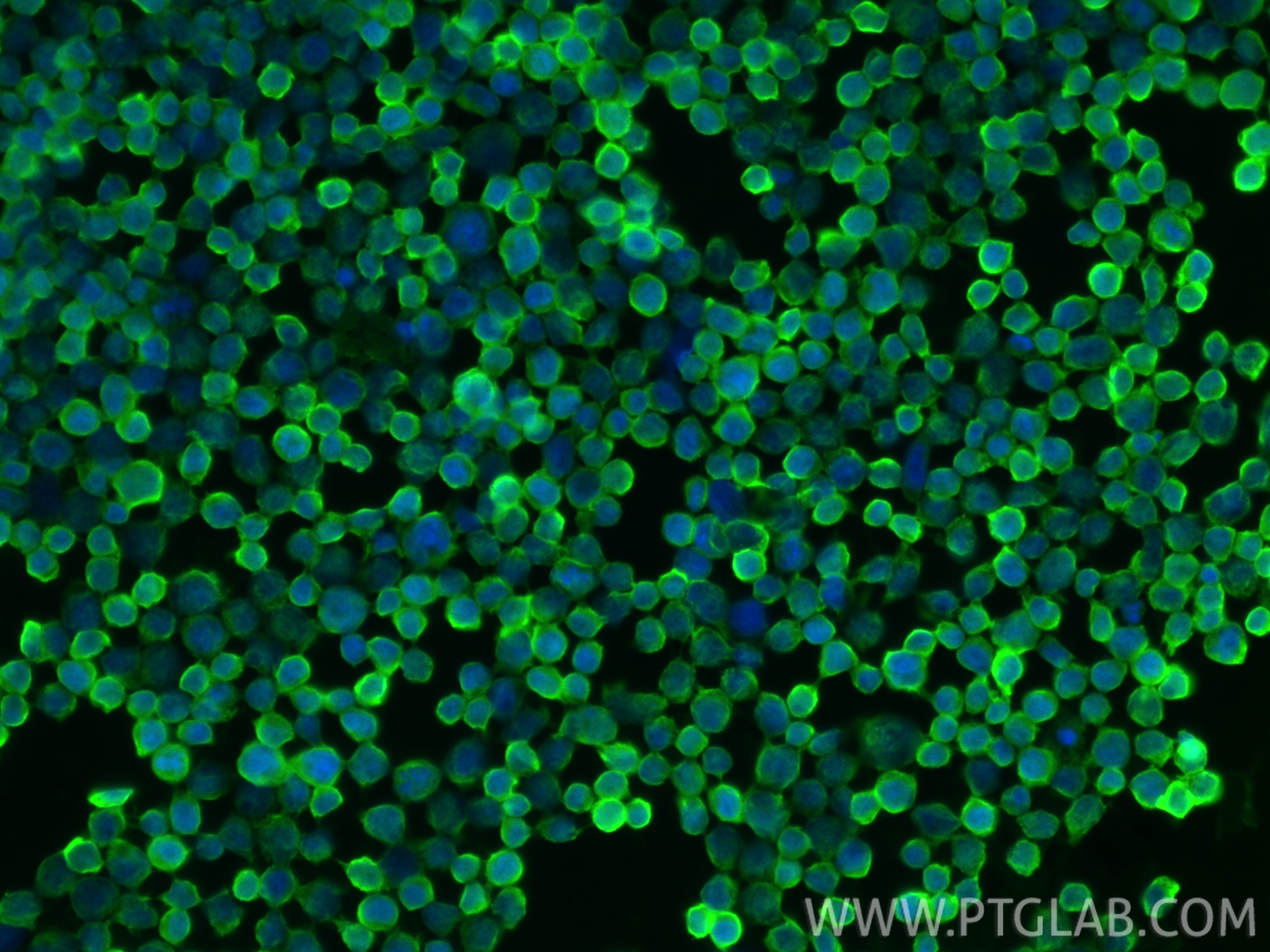 IF Staining of Jurkat using RMX00121 IF Staining of Jurkat using RMX00121