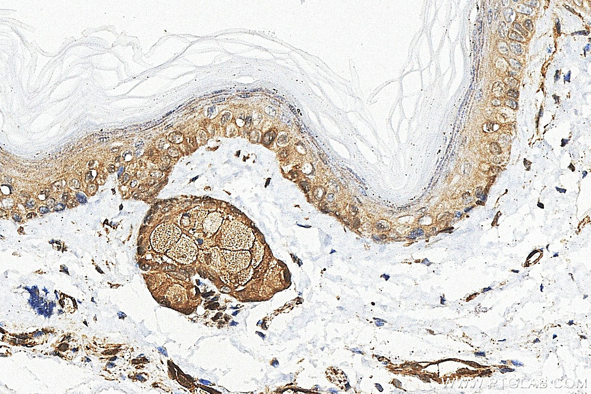 IHC staining of mouse skin using RMX00121 IHC staining of mouse skin using RMX00121