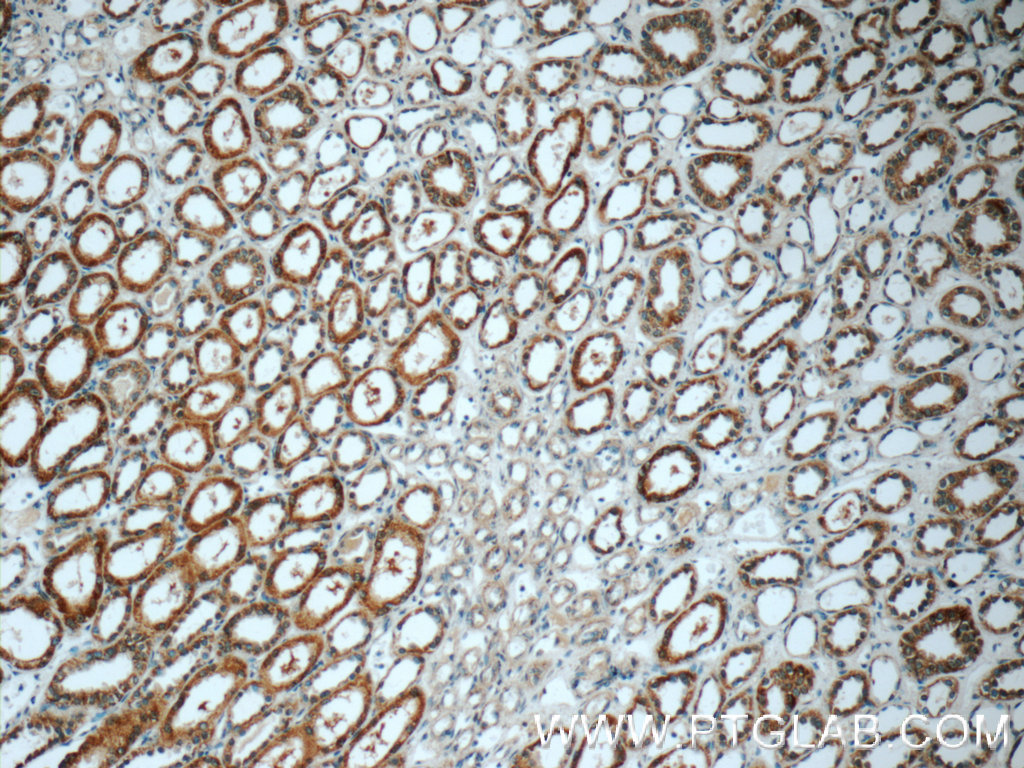 IHC staining of human kidney using 15838-1-AP