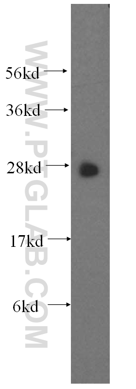 WB analysis of human brain using 15838-1-AP