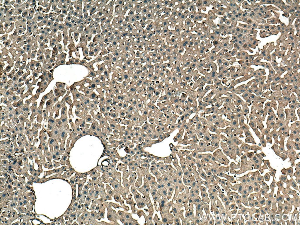 IHC staining of mouse liver using 67645-1-Ig (same clone as 67645-1-PBS)