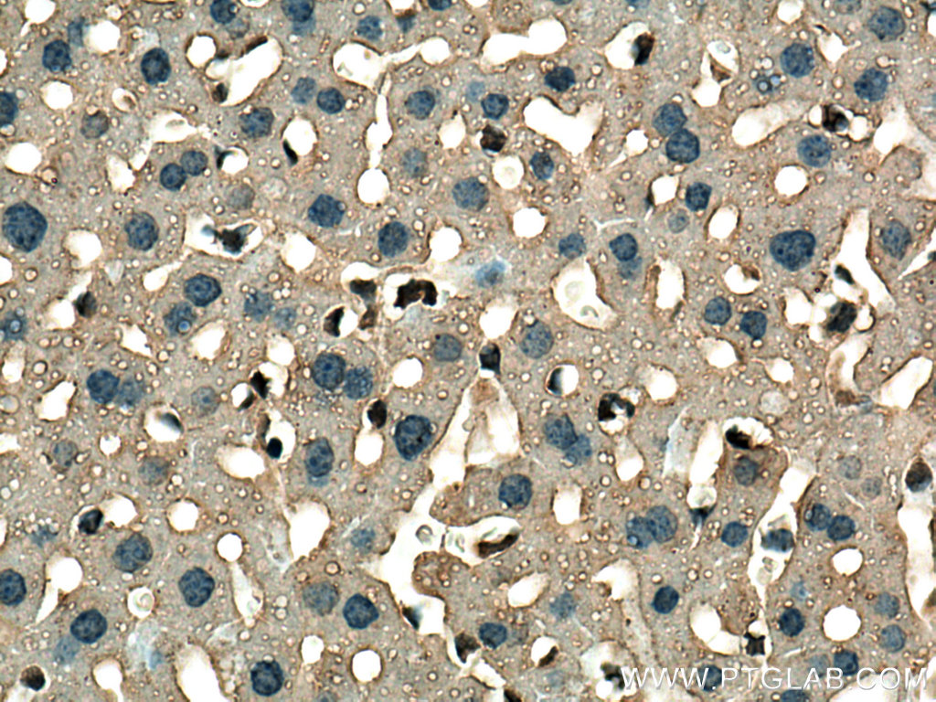 IHC staining of mouse liver using 67645-1-Ig (same clone as 67645-1-PBS)