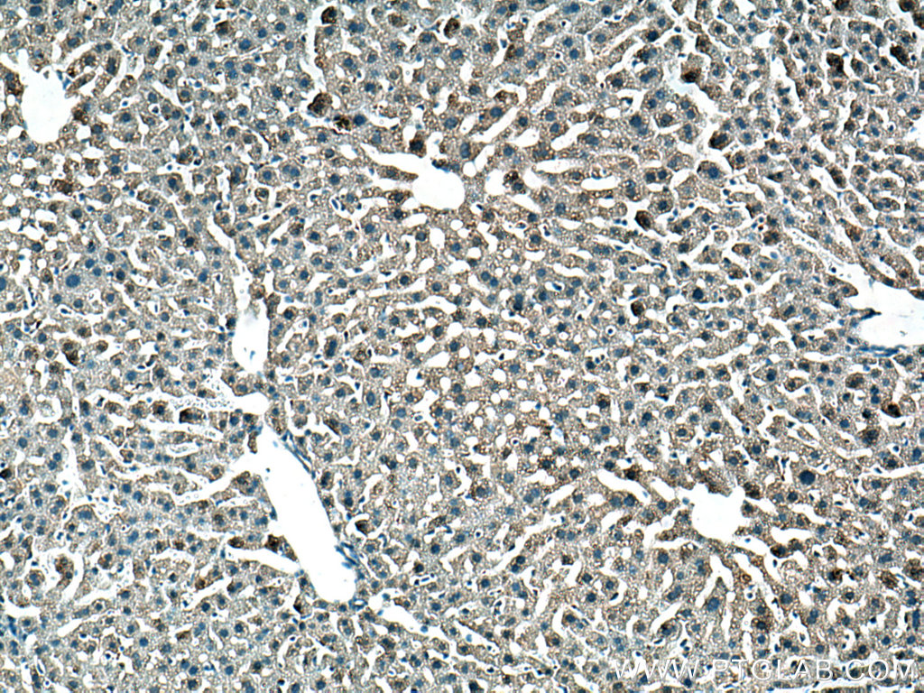 IHC staining of mouse liver using 14889-1-AP