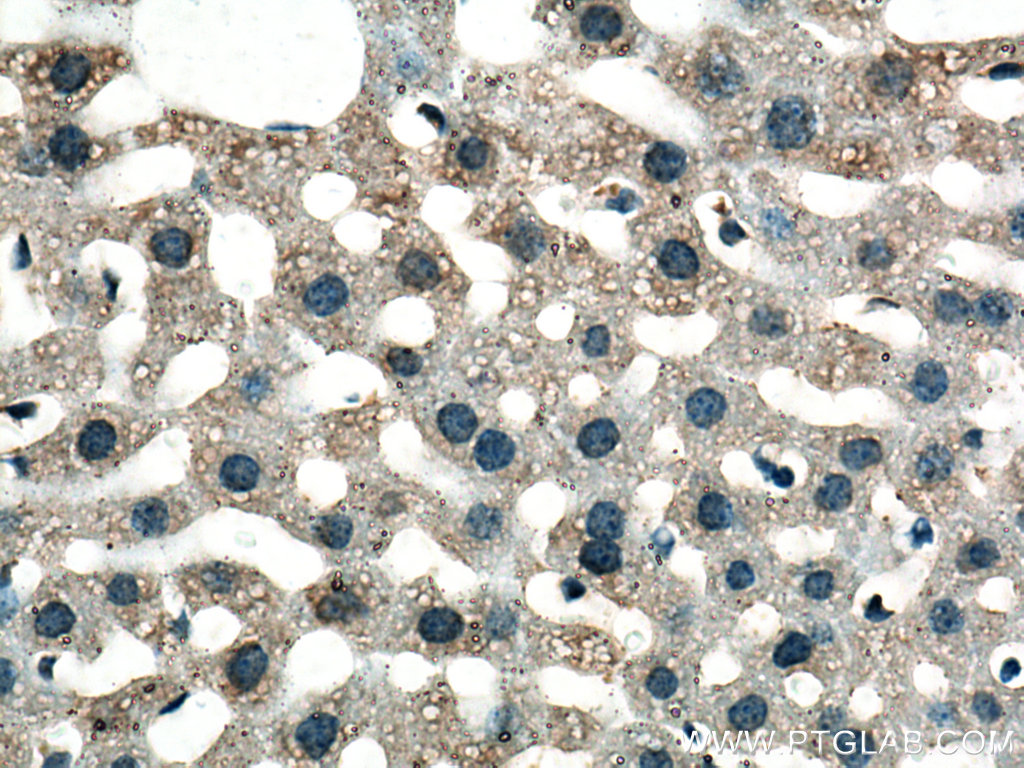 IHC staining of mouse liver using 14889-1-AP