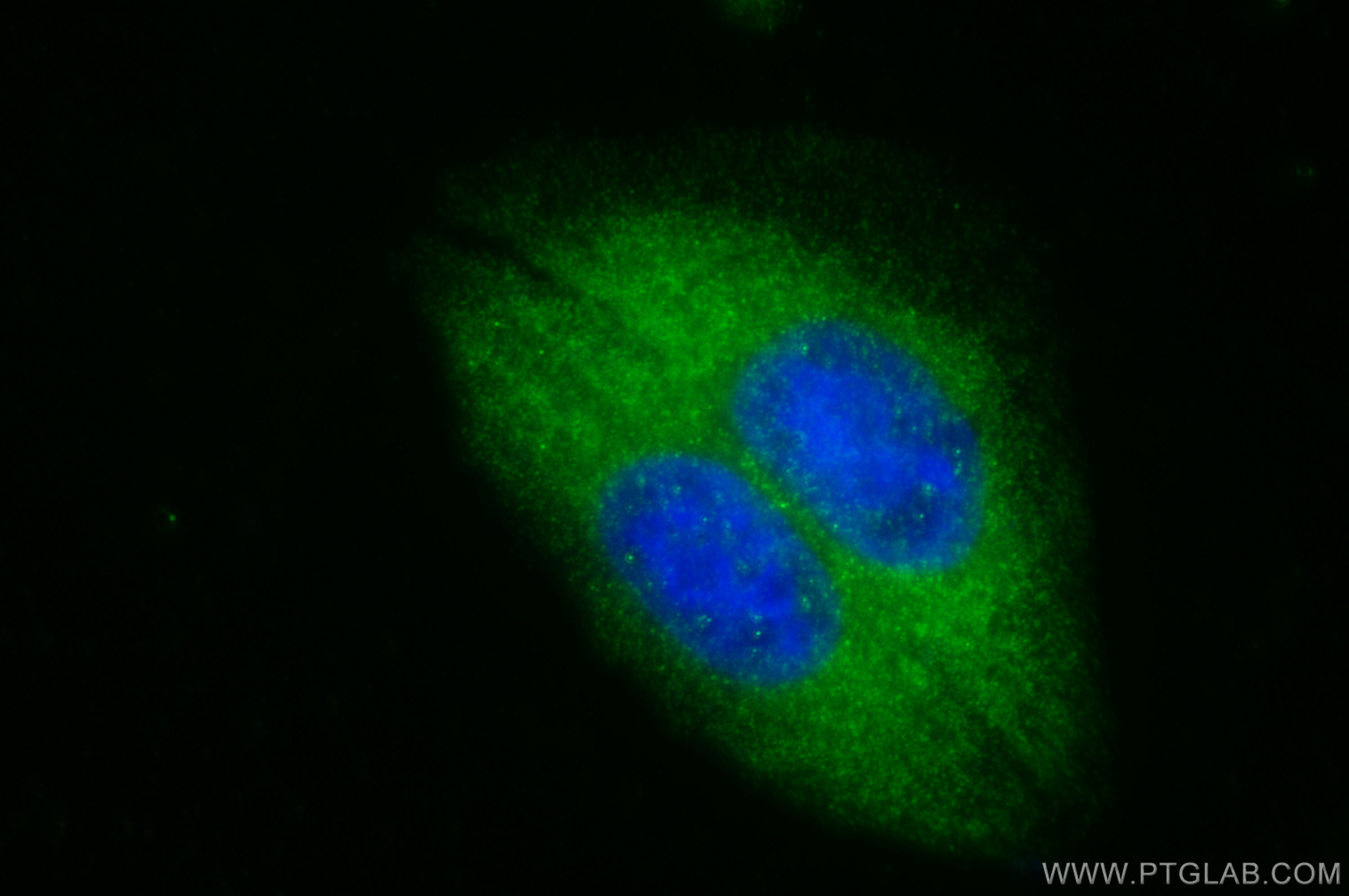 IF Staining of HepG2 using 16666-1-AP