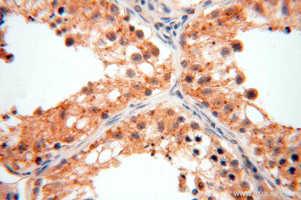 IHC staining of human testis using 16666-1-AP