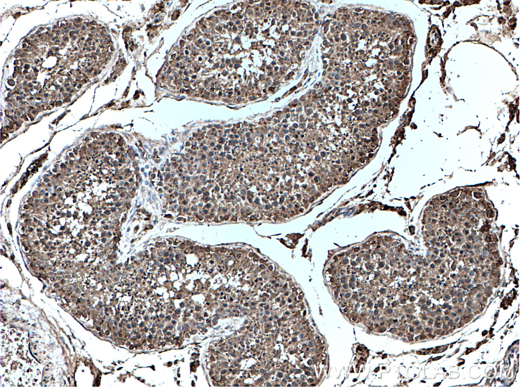 IHC staining of human testis using 66578-1-Ig