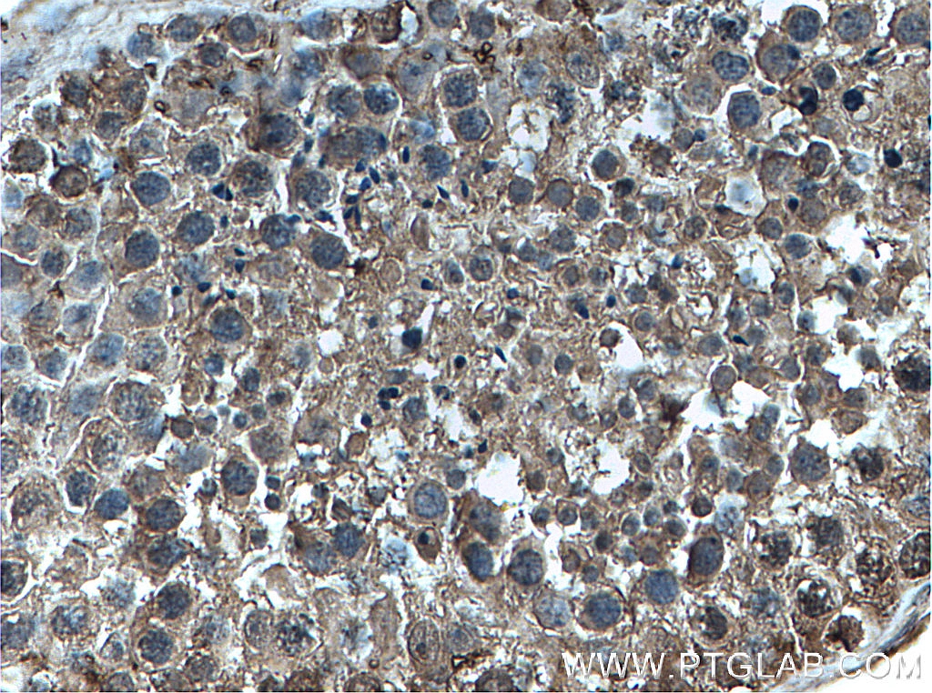 IHC staining of human testis using 66578-1-Ig